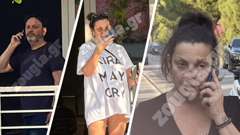 ΤΑ ΣΗΜΑΔΙΑ ΣΤΟ ΠΡΟΣΩΠΟ ΤΗΣ ΠΡΩΗΝ ΣΥΖΥΓΟΥ ΤΟΥ ΣΤΑΘΗ ΑΓΓΕΛΟΠΟΥΛΟΥ