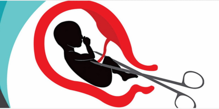 ΕΚΤΡΩΣΕΙΣ: Η ΝΟΜΙΜΟΠΟΙΗΜΕΝΗ ΠΑΓΚΟΣΜΙΑ ΓΕΝΟΚΤΟΝΙΑ